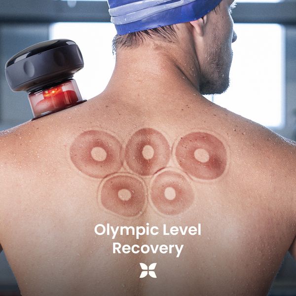 &nbsp;Smart Cupping Massager