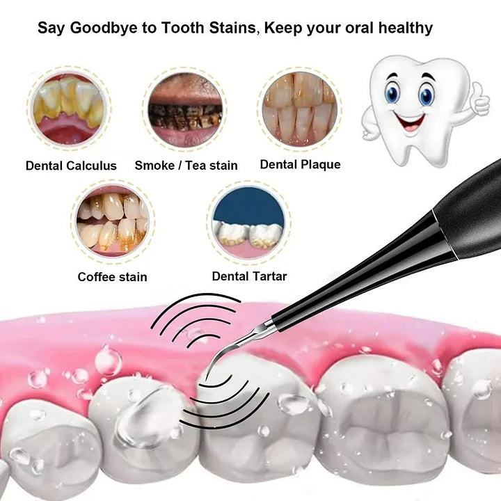 Appareil électrique de nettoyage des dents 2 en 1 - Nettoyeur de dents